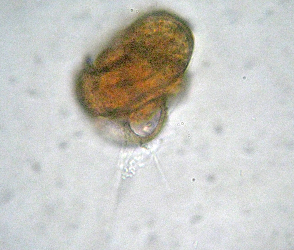 Foraminifera: probabile Glomospira gordialis